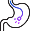Procedimentos Endoscópicos